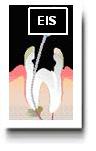 Tooth picture